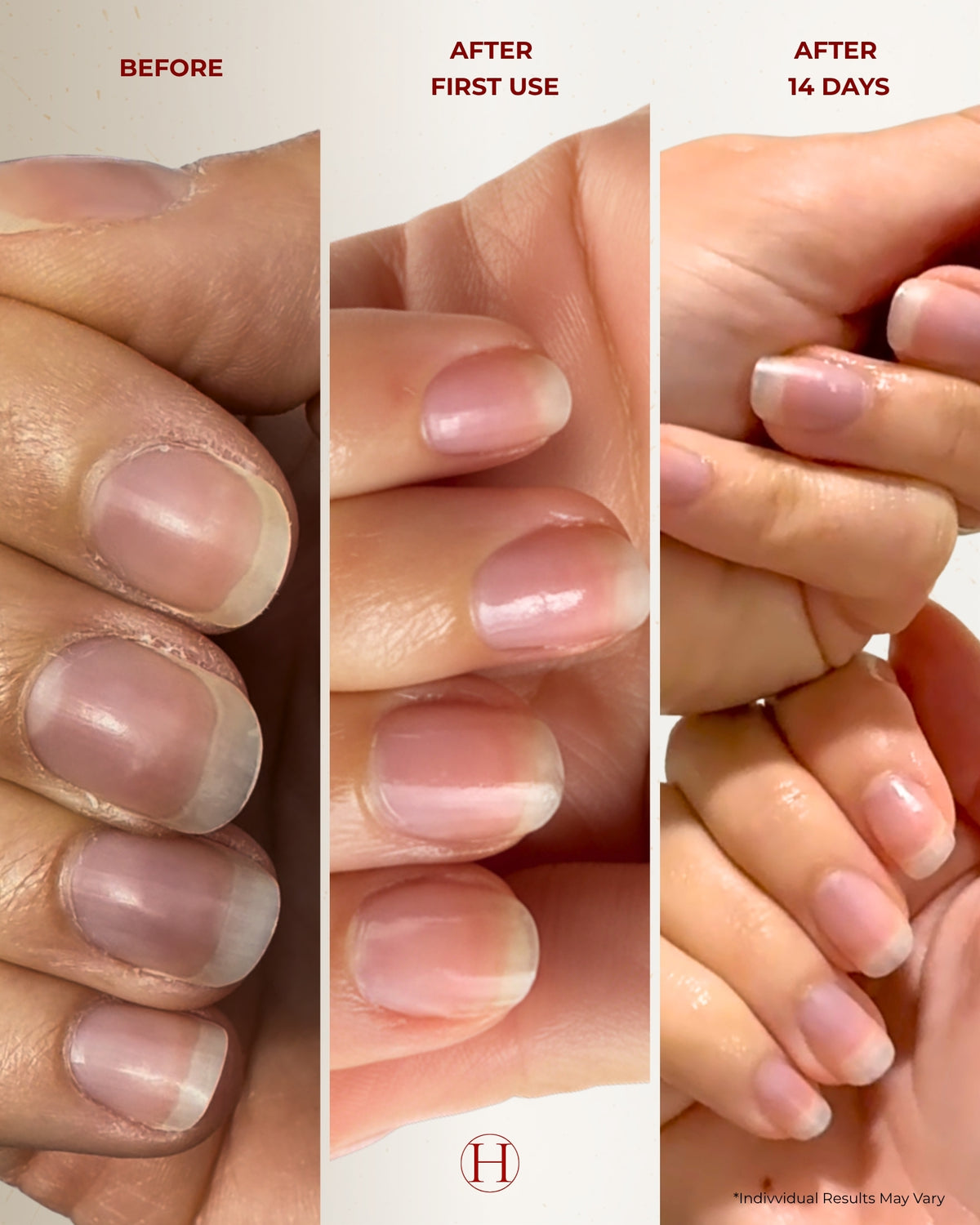 THE CUTICLE PEN