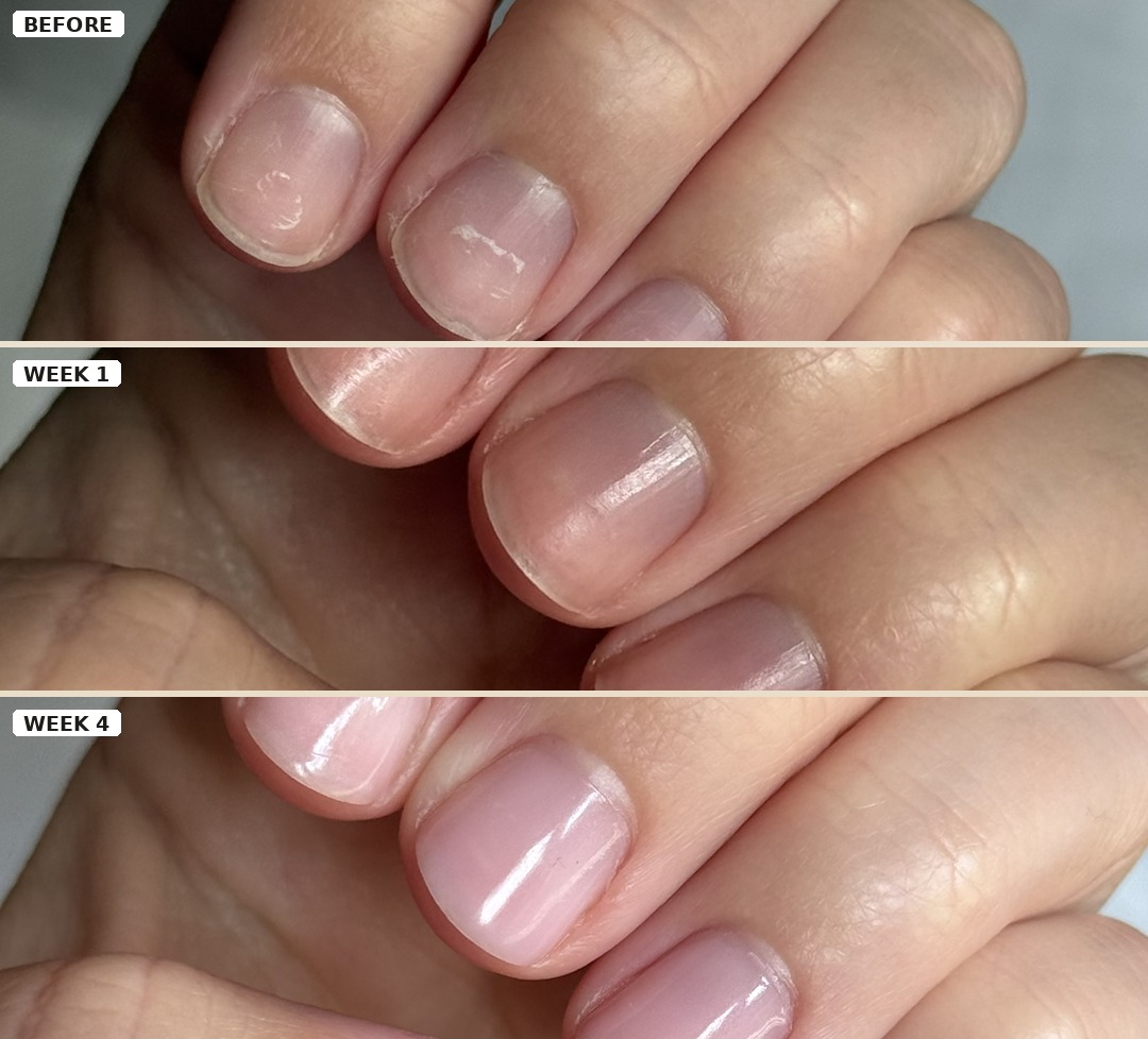 Three horizontal panels show close-up views of a person's fingernails over a 4-week treatment timeline, labeled BEFORE, WEEK 1, and WEEK 4. The nails progress from dry and slightly uneven to smooth, glossy, and neatly shaped.